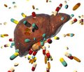 Drug-induced liver damage: principles of diagnosis, pathological changes and treatment approaches
