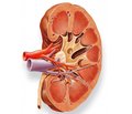 Diagnosis of kidney disease