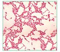 Bacillus сoagulans как эффективный пробиотик в составе препарата Лактовит Форте