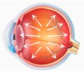 Знову про інгібітори карбоангідрази: сучасні аспекти їх застосування в офтальмології