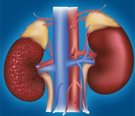 Accounting, treatment access for patients with stage III–V chronic kidney disease and acute renal failure: analysis and assessment