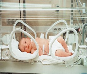 Predicting the Outcomes of Perinatal Nervous System Damage in Preterm Infants