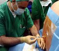 Premedication of Patients before Spinal Anaesthesia in Abdominal Surgery