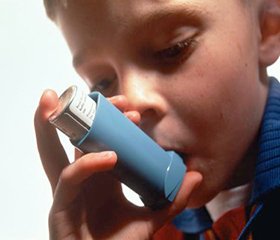 New approach of basic treatment choice in children with mild persistent bronchial asthma.