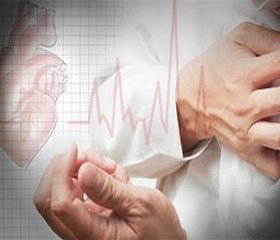 Разрыв миокарда — фатальное осложнение инфаркта?