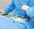 Технічні аспекти симультанних лапароскопічних операцій у хворих на жовчнокам’яну хворобу та супутню хірургічну абдомінальну патологію
